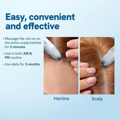 Hair Ball Essence Rosemary Growth Oil